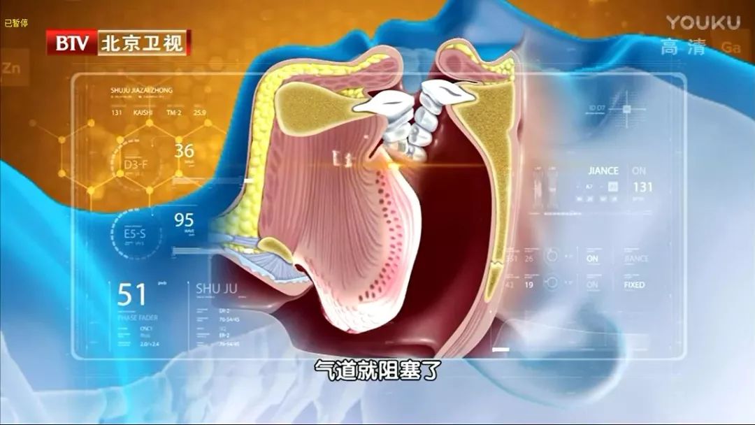 2-250G413550Q29.jpg